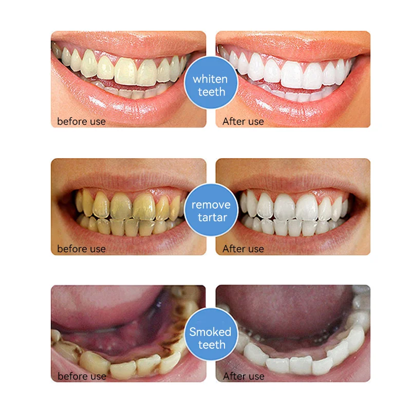 Hydroxyapatite Toothpaste product